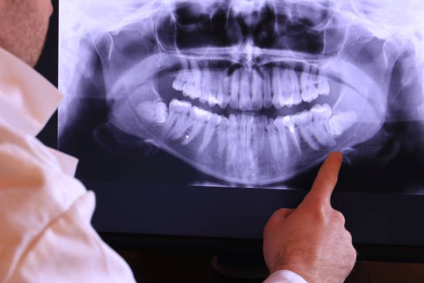 Best After-Hours Emergency Dentist in Smith Mills, MA